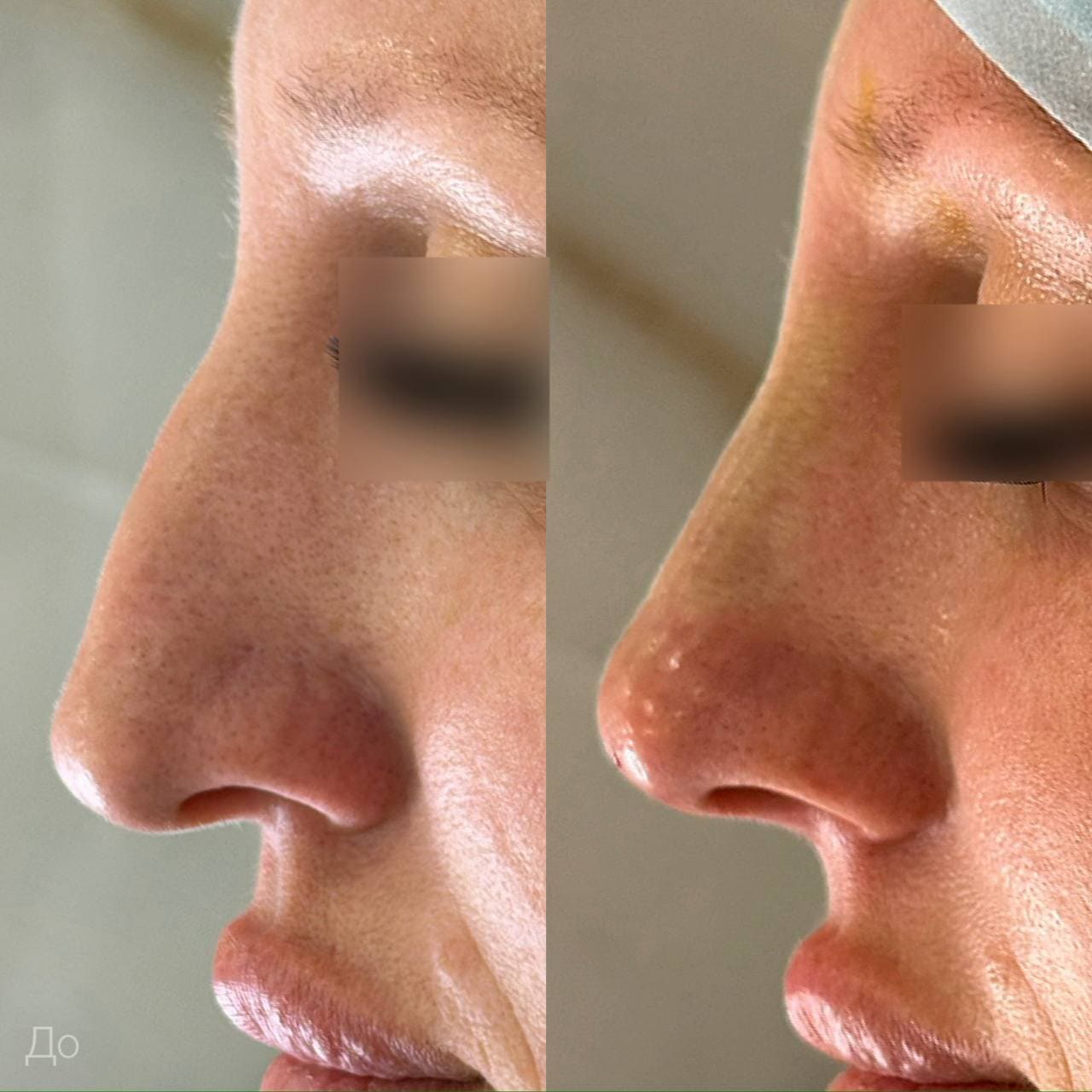 Результат до и после